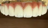 لابراتوار دندانسازی خانلری