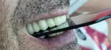 دنتالیوم