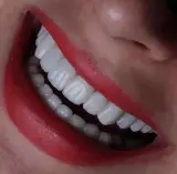 دندانپزشکی دکتر هدیه هدایت زاده رودسری
