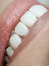 دندانپزشکی دکتر یعقوب بزرگمنش