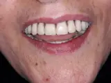 دکتر فردین زارعی متخصص لثه و ایمپلنت