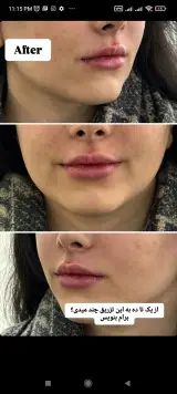 کلینیک زیبایی و ژل و بوتاکس آلبا