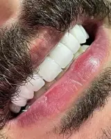دندان سازی سهراب اسلوب