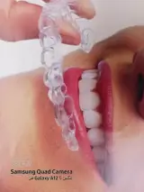 لابراتوارتخصصی دندان رفاه