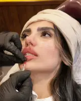 مرکز لیزر و کلینیک زیبایی و بوتاکس ستایش