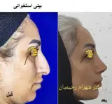 دکتر شهرام رحیمیان جراح زیبایی