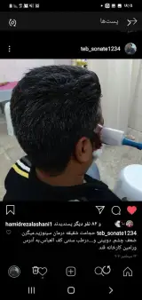 طب سنتی وسوزنی حسینی