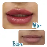 کلینیک پوست مو زیبایی نگار