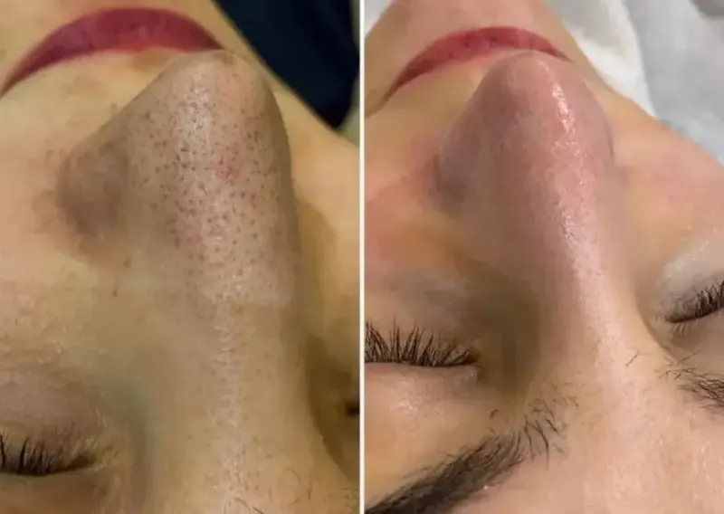 آرایش دائم پدیکور کفسابی و درمانی نفس