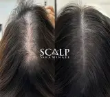 خدمات میکرواسکالپ سر سارا مینایی