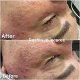 مرکز لیزر و پاکسازی پوست روژین