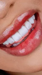 دندانپزشکی دکتر یاسمن نجفی(نقد واقساط)
