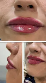 کلینیک لیزر وزیبایی لوانا