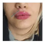 کلینیک زیبایی، پوست ،مو و لیزر مهرینا
