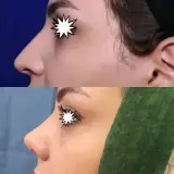 دکتر زهرا فراهانی نیک