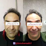 مرکز پوست مو و زیبایی دکتر سارا محمدی