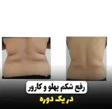 مرکز لاغری رادیکال