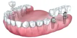 دندانپزشکی مطب دکتر هدیه هدایت زاده