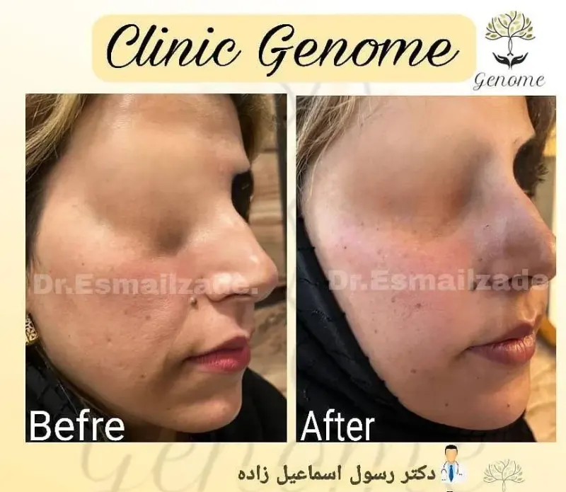 کلینیک پوست دکتر اسماعیل زاده