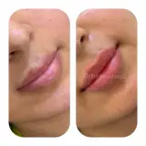 کلینیک تخصصی ژل و بوتاکس مرضیه آقابابایی