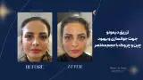 کلینیک زیبایی آرا مهر