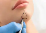 کلینیک زیبایی لیزر بیوتی