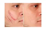 اکستنشن مژه مرجان قزوین