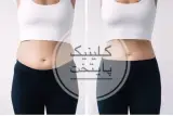 کلینیک لاغری و زیبایی پایتخت