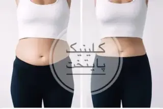 کلینیک لاغری و زیبایی پایتخت