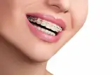 دندان پزشکی عطار دکتر میرخانی
