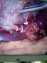 مطب دکتر فرج زاده