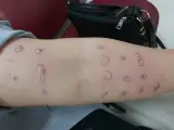 مطب فوق تخصصی آسم،آلرژی و نقص ایمنی