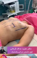 دکتر مجید نداف کرمانی فوق تخصص جراحی پلاستیک