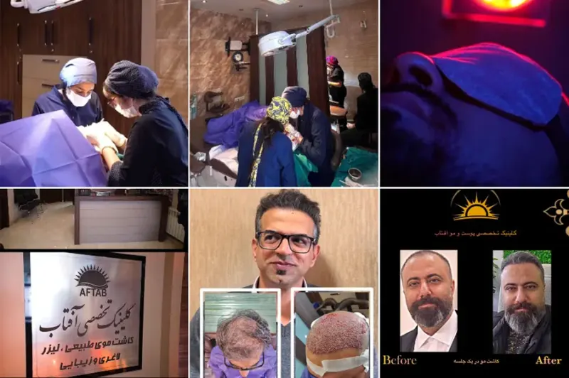 کلینیک تخصصی کاشت مو و زیبایی آفتاب