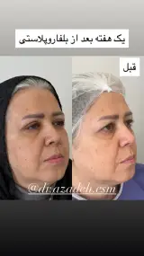 کلینیک زیبایی و لیزر دکتر آزاده اسماعیلی