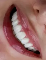 کلینیک دندانپزشکی خاورمیانه نقد و اقساط