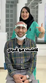 کلینیک کاشت مو رز