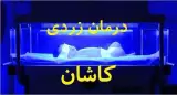 درمان زردی نوزاد نوین طب کاشان