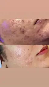 کلینیک زیبایی، فیشال امینی