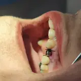 کلینیک دندانپزشکی دکتر زریون