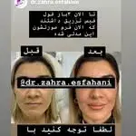 کیلینیک لیزر ونوس