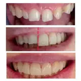 دندانپزشکی دکتر عبدالکریم عزیزی