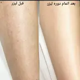 مرکز لیزر یاس