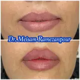 دکتر پوست مو زیبایی میثم رمضانپور خاکی