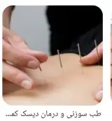 طب سنتی عامری (حجامت و بادکش)