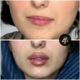 کلینیک زیبایی نوژ