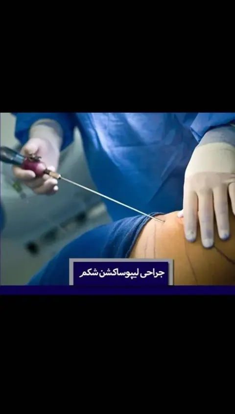 عمل جراحی زیبایی