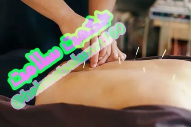 طب سوزنی وطب سنتی