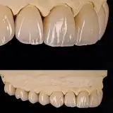 کلینیک دندانپزشکی دکترهمتی (بصورت اقساط)