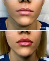 کلینیک زیبایی چشمه